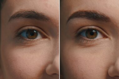 antes y despues del laminado de cejas