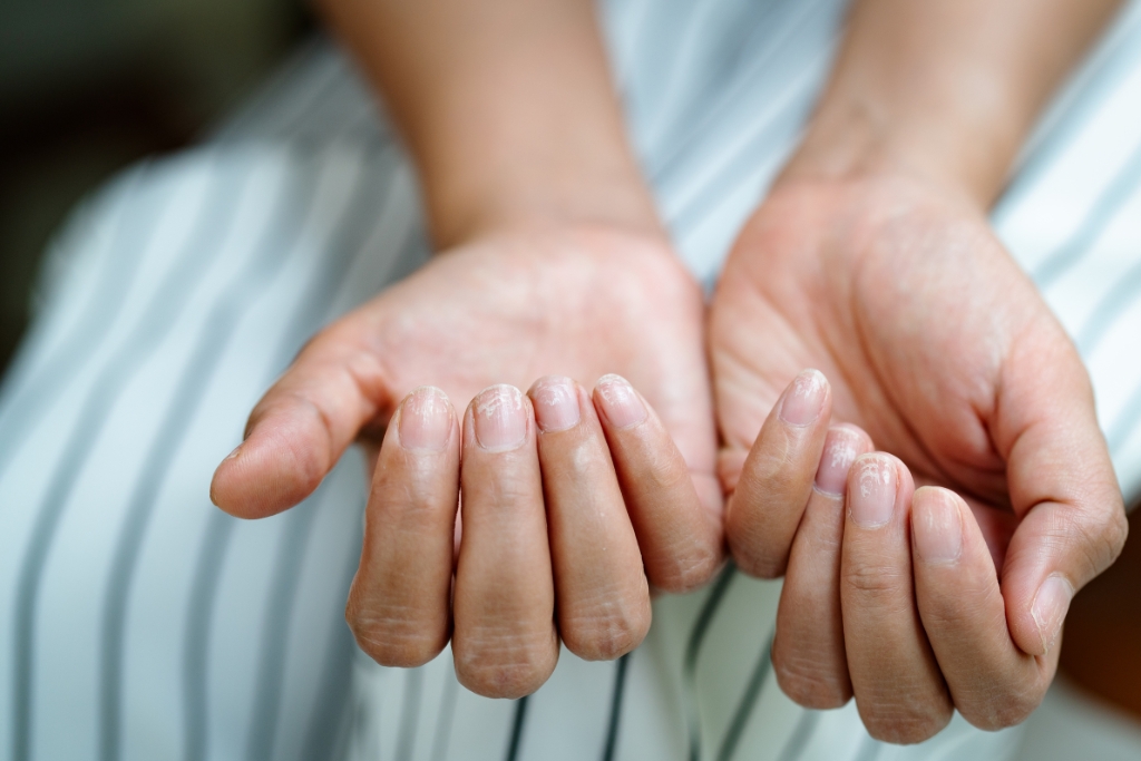 Cómo fortalecer las uñas dañadas: consejos, causas y tratamientos